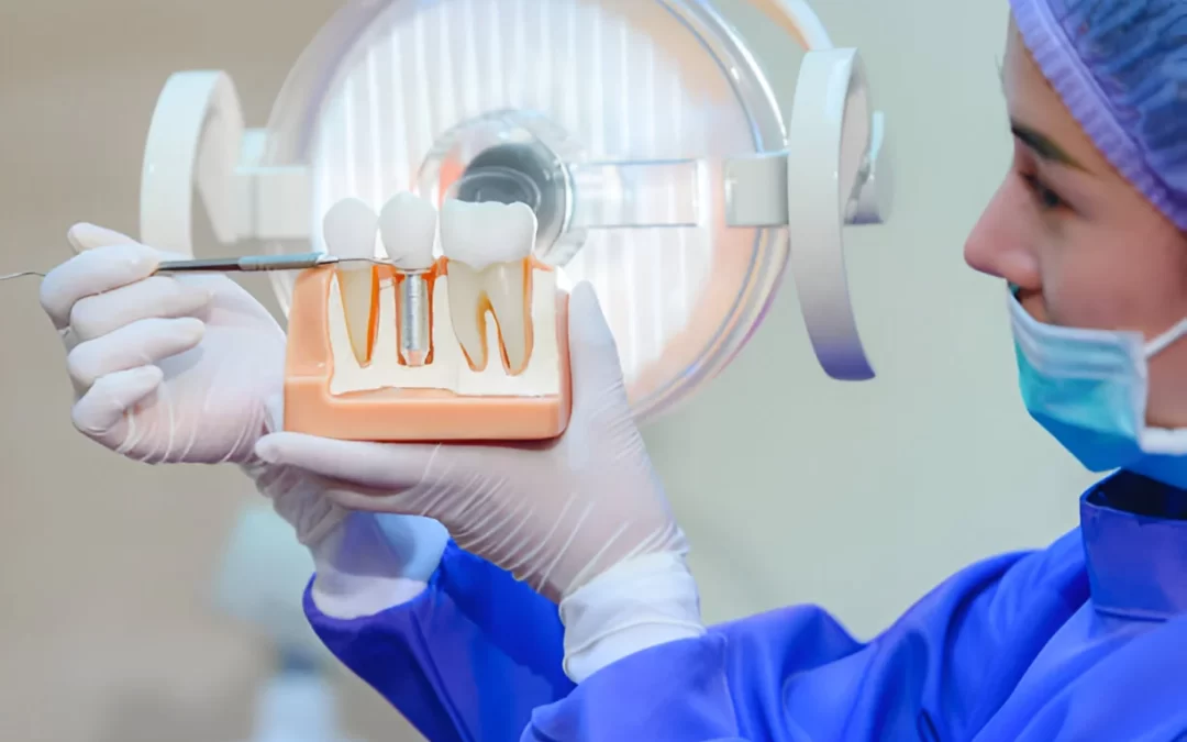 Immediate Implant After Tooth Extraction: How It Saves Time for Patients and Dentists
