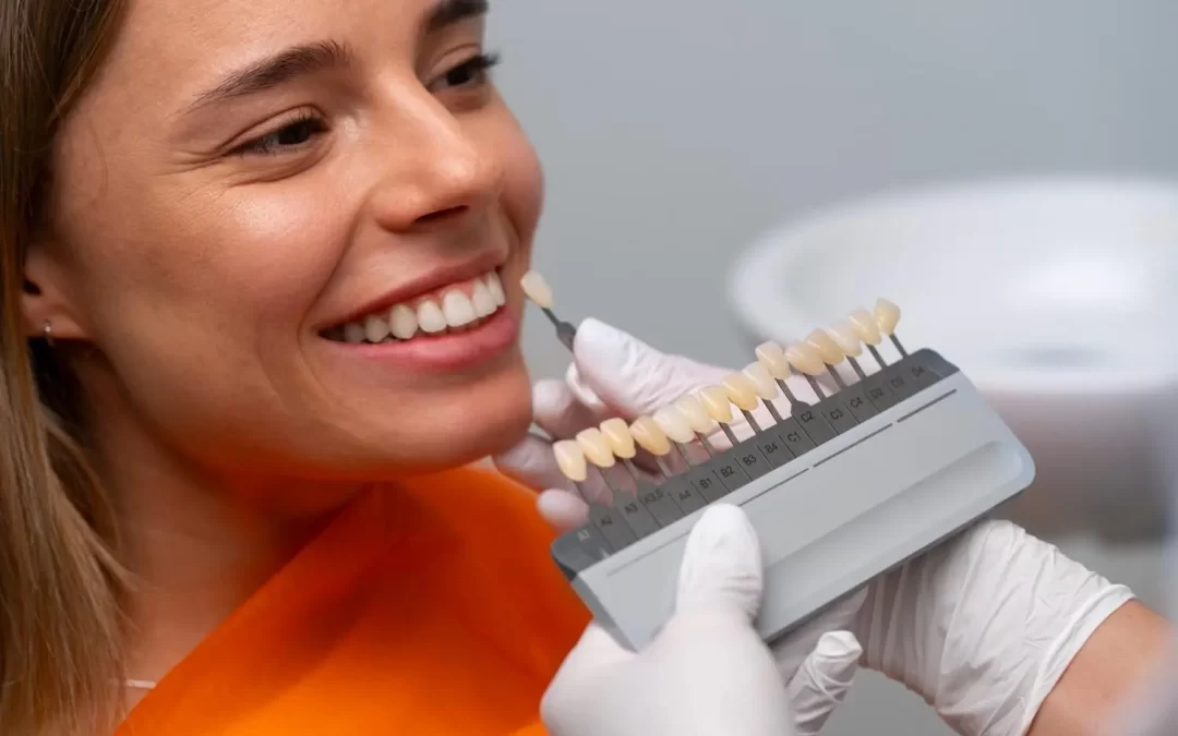 Veneers & Laminates at Orosmyle: A Simpler Choice Than Picking Your Nail Shade