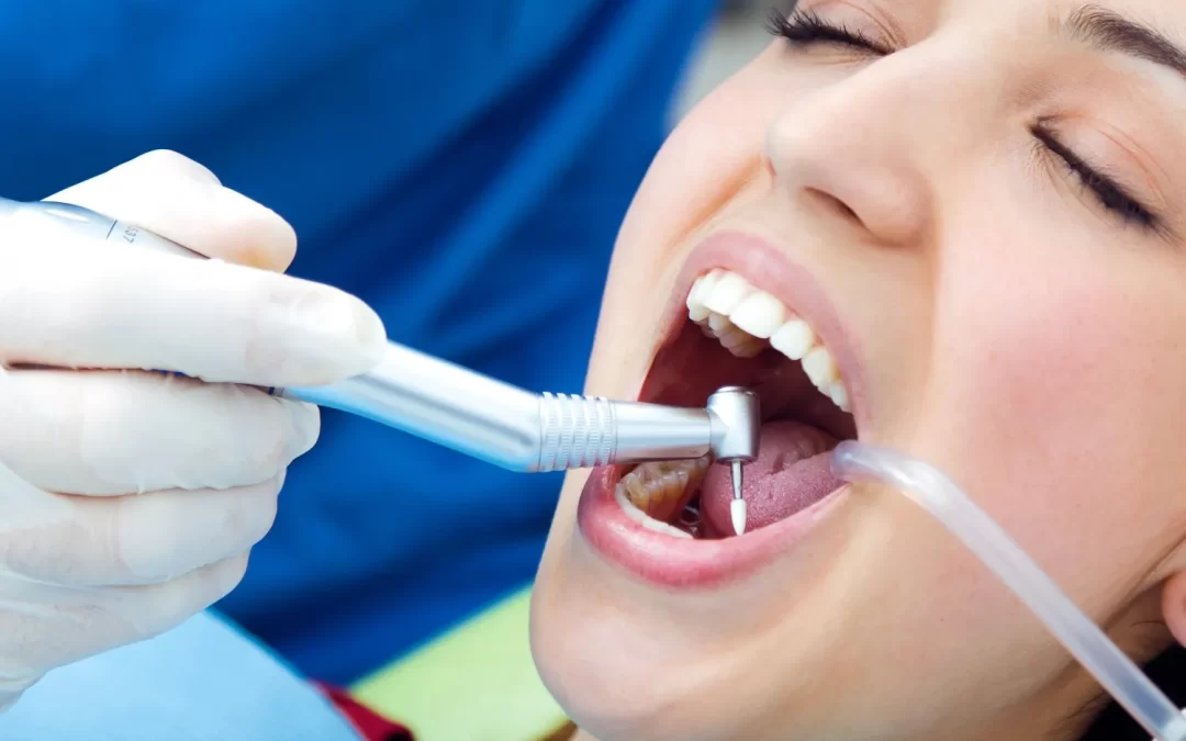 What Are Dental Fillings? A Comprehensive Guide of Types, Materials & Procedures